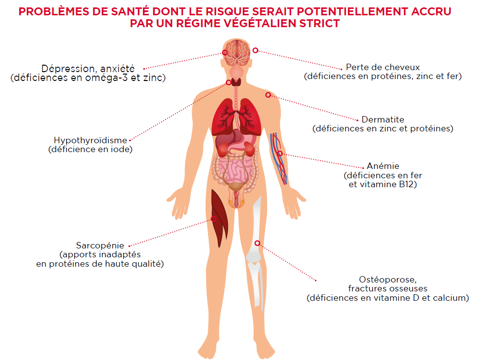 problemes sante vegetalien source O’Keefe et al., 2022